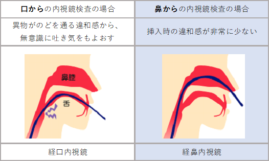 経鼻的内視鏡検査の比較